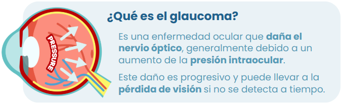 ¿Qué es el glaucoma? El glaucoma es una enfermedad que daña el nervio óptico